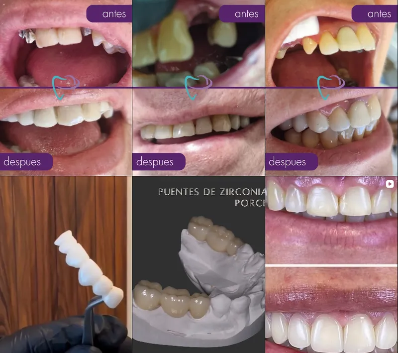 Guardia odontológica y urgencias dentales en Pilar en Odonto Concord